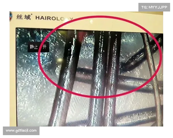 男性必看!这个部位的毛发变白,竟暗示寿命在悄悄减少(男性体毛变白是什么原因) 男性必看!这个部位的毛发变白,竟暗示寿命在悄悄减少(男性体毛变白是什么原因)